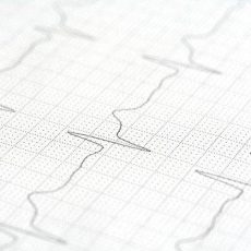 Offene Rhythmus-Sprechstunde – Patientenseminar (Seminar | Essen)