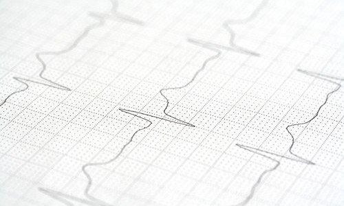 Patienteninfo: Offene Rhythmus-Sprechstunde (Sonstiges | Essen)