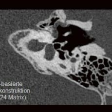 DEEP-Learning-Rekonstruktion in der Neuroradiologie (Webinar | Online)