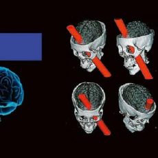 Outside the box-Vortrag: die Neuroradiologie der Moral (Webinar | Online)