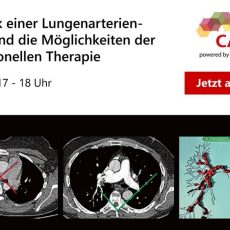 Diagnostik einer Lungenarterien­embolie und die Möglichkeiten der interventionellen Therapie (Webinar | Online)