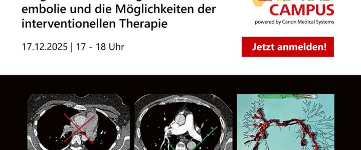 Diagnostik einer Lungenarterienembolie und die Möglichkeiten der interventionellen Therapie (Webinar | Online) Diagnostik einer Lungenarterienembolie und die Möglichkeiten der interventionellen Therapie (Webinar | Online)